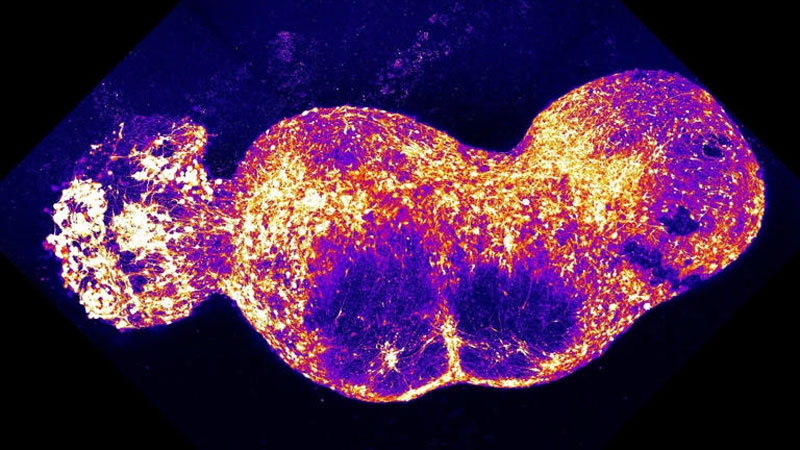 Учёные впервые вырастили полный нервный контур для передачи боли в мозг — его проверили острым перцем