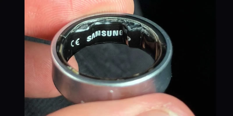 Вздувшаяся батарея Galaxy Ring зажала палец пользователя и отправила его в больницу